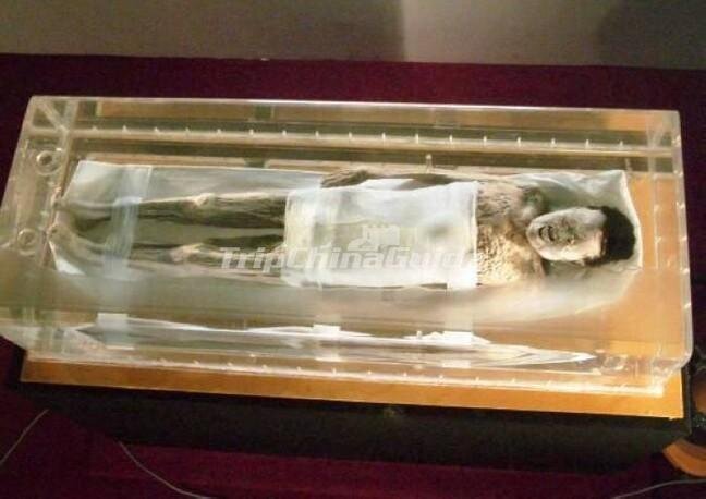 2 min ildir ölməyən qadın