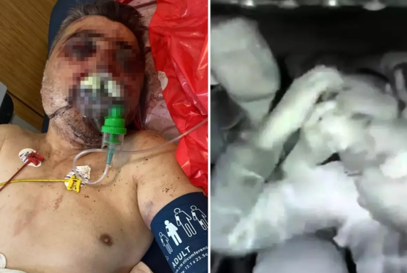 Məşhur boksçu taksi sürücüsünü döyüb - VİDEO