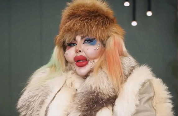 İranlı bloqer estetik əməliyyatların sayına görə rekord vurub