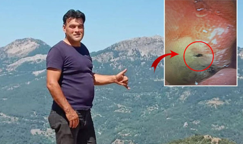 Dəhşətli hadisə! Mədəsindən canlı böcək çıxarıldı