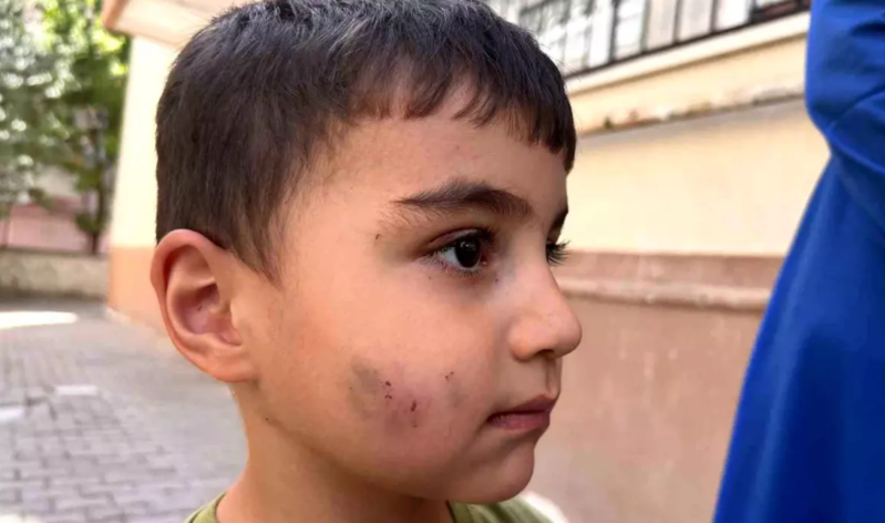 Siçan dişləyən uşağa quduzluq iynəsi olundu - VİDEO