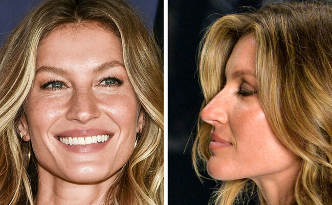 Bu məşhurlara bir də profildən baxın - FOTOLAR