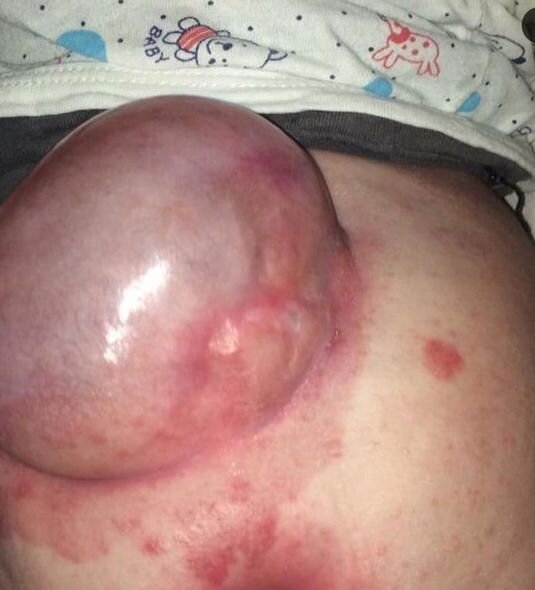 Beş yaşlı qızın sağlam böyrəyinin xilas olunmasına kömək edin - Yardım ÇAĞIRIŞI + FOTO