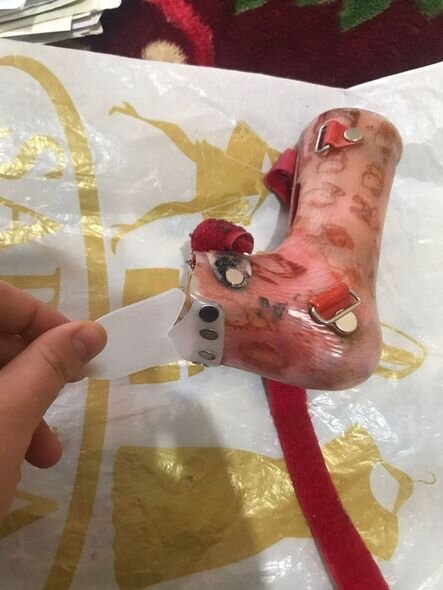 Beş yaşlı qızın sağlam böyrəyinin xilas olunmasına kömək edin - Yardım ÇAĞIRIŞI + FOTO