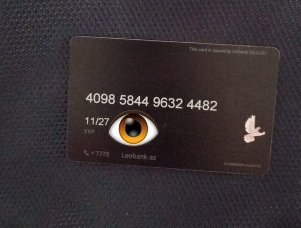 11 yaşlı Əsmanın müalicəsi üçün 300 manata ehtiyacı var - FOTO