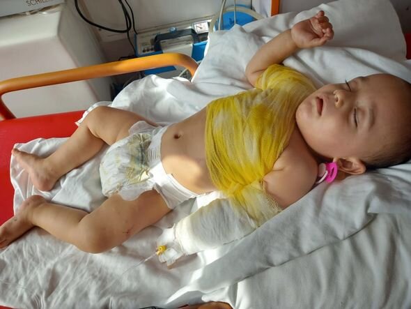 Bir yaşlı körpə yeriməyə çalışarkən qaynar suda yanıb - FOTO