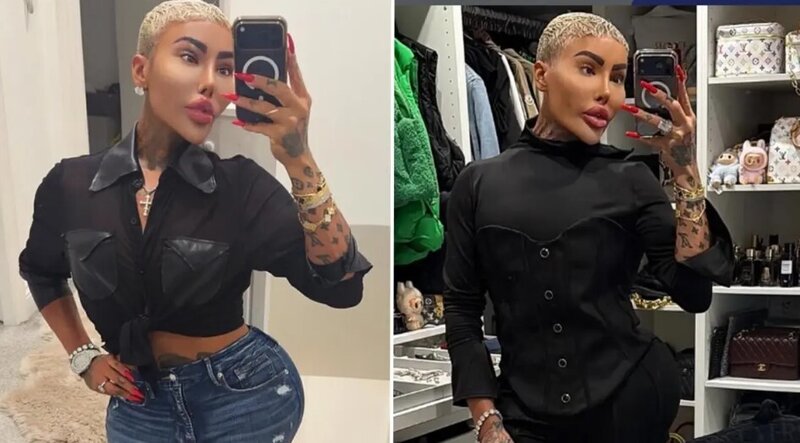 Kim Kardashiana bənzəmək üçün çoxsaylı estetik əməliyyatlar etdirən fenomen öldü