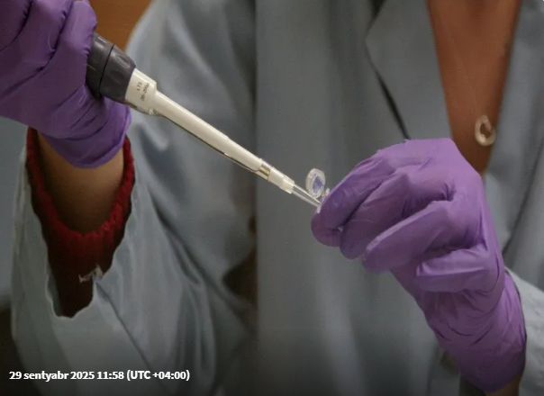 Kişi DNT testi etdi: uşaqları haqqında həqiqəti öyrəndi