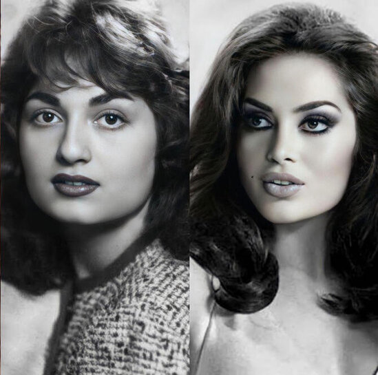 Türkan Şorayı dəyişdirən plastik əməliyyatlar və qiymətləri - FOTO