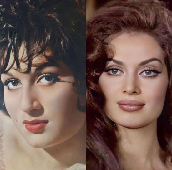 Türkan Şorayı dəyişdirən plastik əməliyyatlar və qiymətləri - FOTO