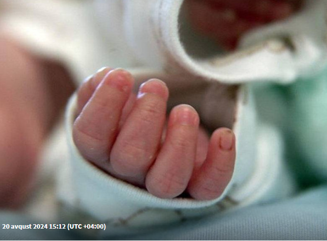 Dərisiz körpə doğuldu - Həkimlər ŞOKDA