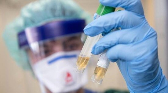 Koronaya yoluxanların sayı yenə ARTDI