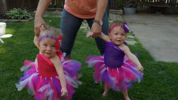 Doğulanda əl-ələ tutan əkizlər indi də ayrılmırlar - FOTOLAR