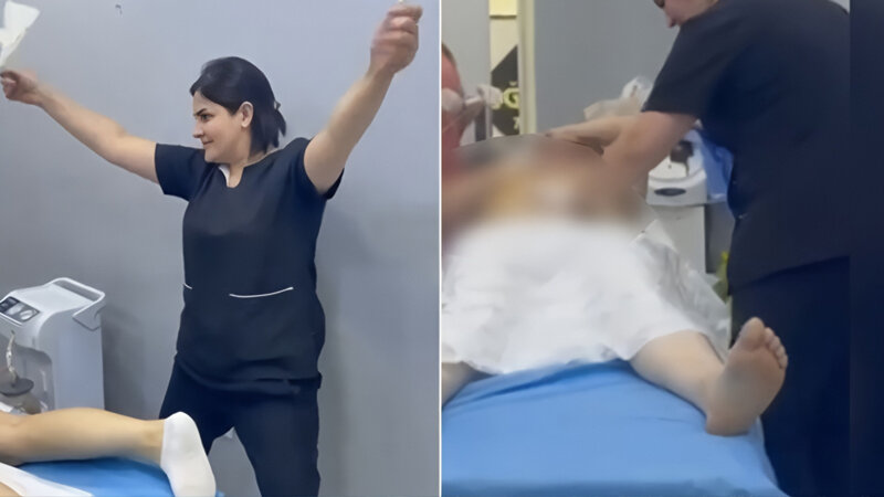 Saç ustası liposaksiya əməliyyatını necə edir?