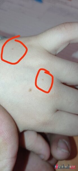 Məktəbdə tükürpədici olay: İki azyaşlı şagirdə iynə vurulurmuş (İDDİA)