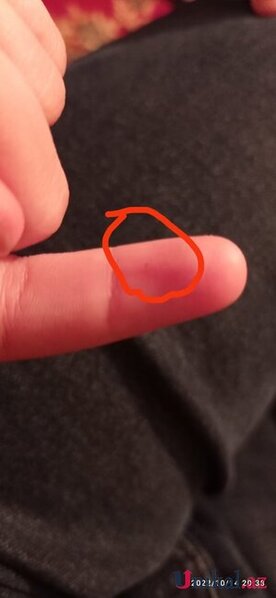 Məktəbdə tükürpədici olay: İki azyaşlı şagirdə iynə vurulurmuş (İDDİA)