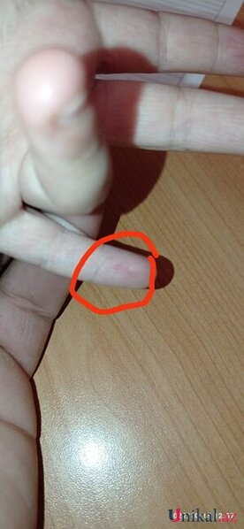 Məktəbdə tükürpədici olay: İki azyaşlı şagirdə iynə vurulurmuş (İDDİA)