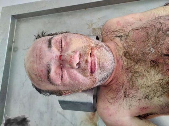 Mərdəkanda yeni tikilməkdə olan binanın həyətində naməlum kişi meyiti tapıldı - FOTO