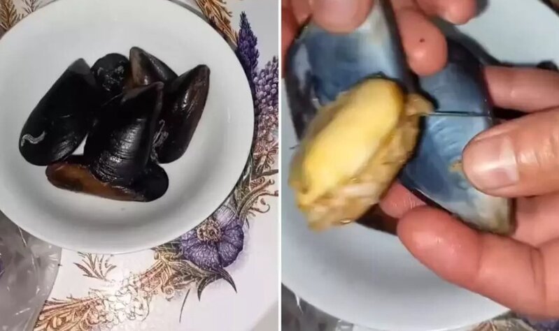 Midyənin içindən çıxan maddələr izləyənləri şok etdi: "Midyəyə baxışımız tamamilə dəyişdi" - VİDEO