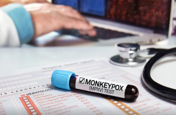 Meymunçiçəyi yeni ölümcül pandemiyaya çevrilə bilər - ÜST-dən XƏBƏRDARLIQ