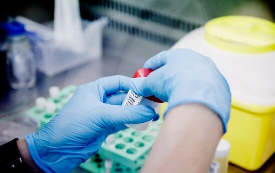 Meymunçiçəyi bu ölkələrə də çatdı