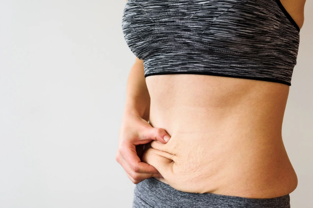 Arıqlayan zaman dəri sallanmasından necə xilas olaq? Ekspert tövsiyələri