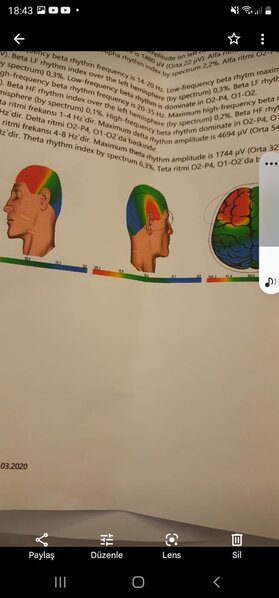 Nurayın köməyinizə ehtiyacı var