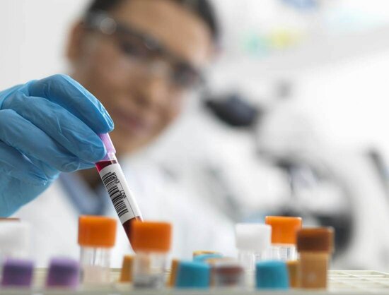 Heyvan saxlayan şəxslər bu virusdan öldülər