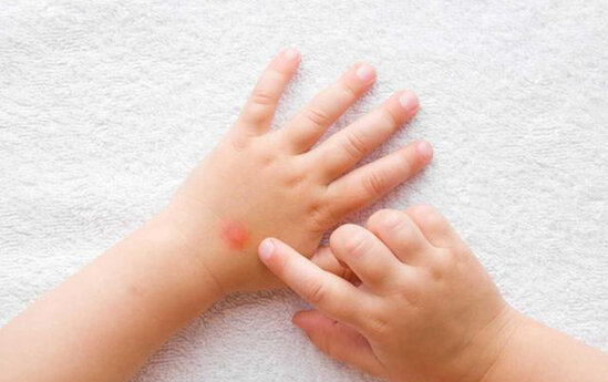 Hindistanda yeni virus yayılır - "Pomidor qripi"