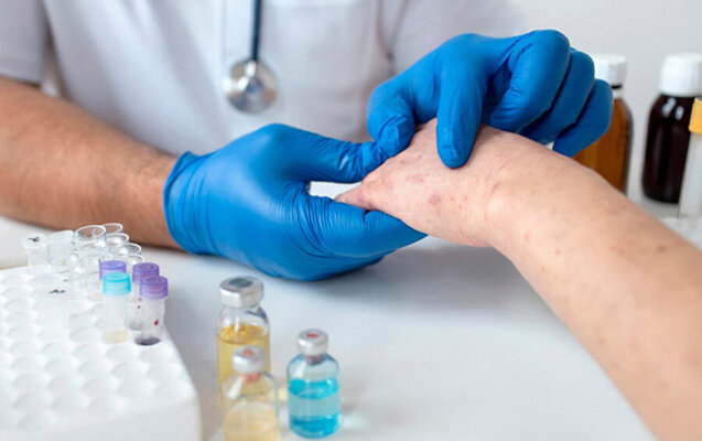 Qızılca ilə bağlı vəziyyət nəzarət altındadır? - TƏBİB rəhbərindən AÇIQLAMA