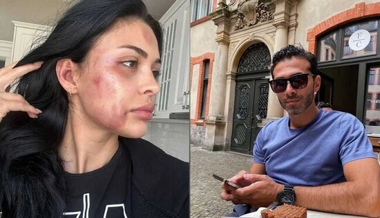 Razi Əliyevanı döyən Ziya məşhur siyasətçinin qohumu imiş