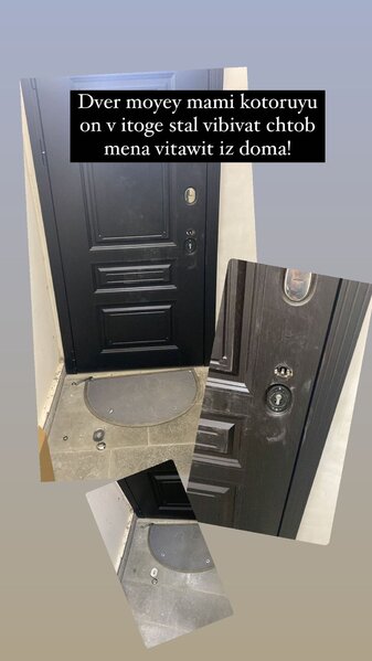 Azərbaycanlı model sevgilisi tərəfindən döyüldü - Foto