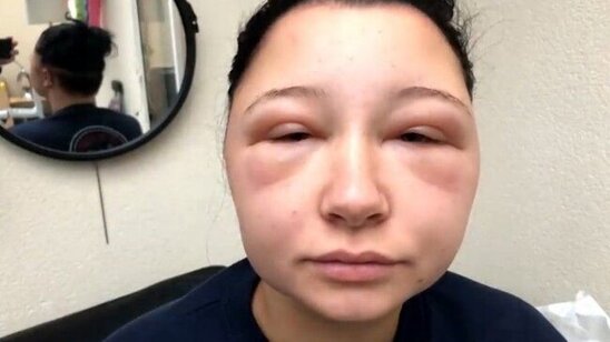 Saç boyasından insan ölə bilərmi?