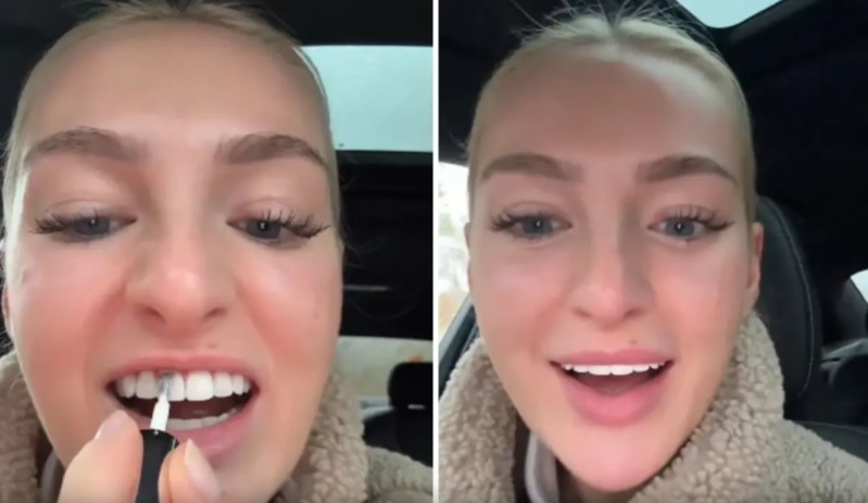 Sosial şəbəkədə gündəm olan görüntü: Dişlərini ağartmaq üçün onları dırnaq boyası ilə rənglədi - VİDEO