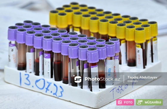 Səhiyyə Nazirliyinin eksperti: "Hepatit C müasir dərmanlarla tam müalicə oluna bilir"