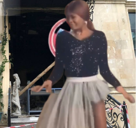 Partlayışda yaralanan seneqallı qızın vəziyyəti necədir?