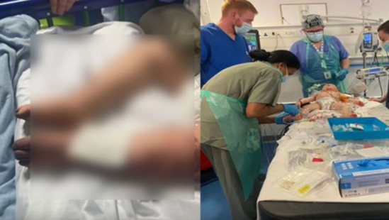 17 aylıq bu uşağın barmaqları kəsilə bilər - FOTO