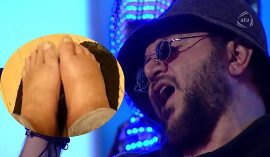 Rəhim Rəhimlinin son videosu paylaşıldı – Ayaqları şişib