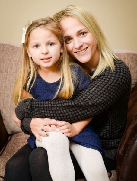 Bu qız "təlxək burnu" ilə doğulub - İllər sonrakı HALI - FOTO