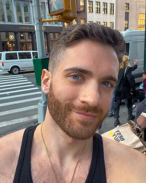 Xəstəlikdən sağalan məşhur aktyor meymunçiçəyi ilə bağlı təcrübəsini bölüşdü - FOTO/VİDEO