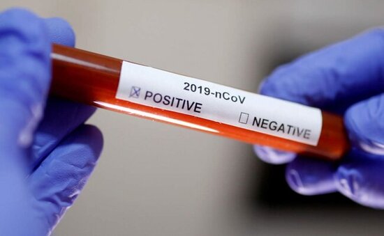 Son sutkada yoluxanların sayı