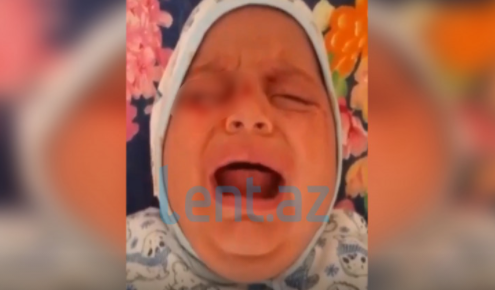 Azərbaycanda gözlərindən qan gələn uşaqla bağlı YENİ XƏBƏR - "Hələ də..."