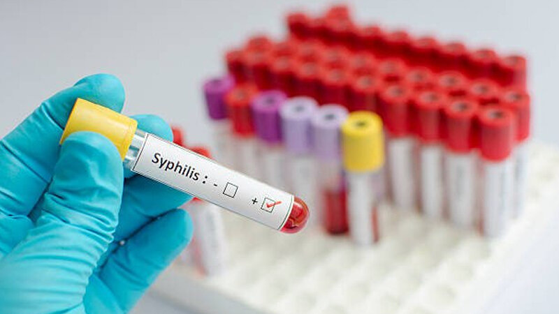 Azərbaycanda 24 uşaq sifilisə necə yoluxub?