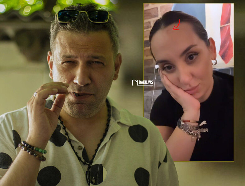 Taleh Yüzbəyov həyat yoldaşını siqaretlə YANDIRDI - VİDEO