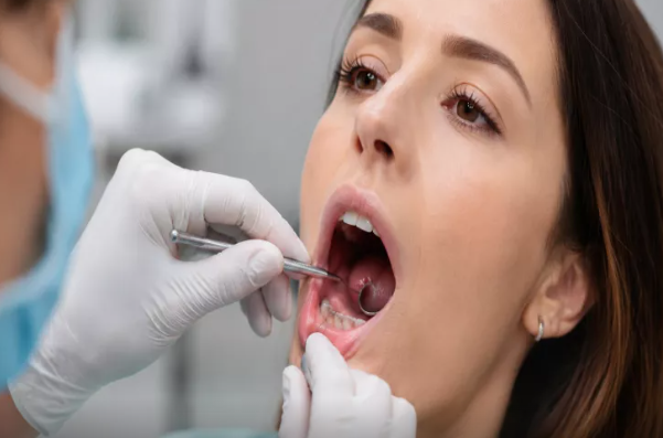 Ağız xərçəngi çox vaxt nəzərə çarpmayan bir əlamətlə başlayır - nəyə diqqət yetirmək lazımdır?