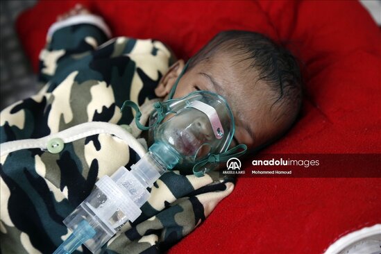 Yəməndəki uşaqların halı ürək ağrıtdı - FOTOLAR