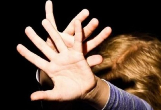 Söyüşə görə dostunun üzünə "kislota" tökdü