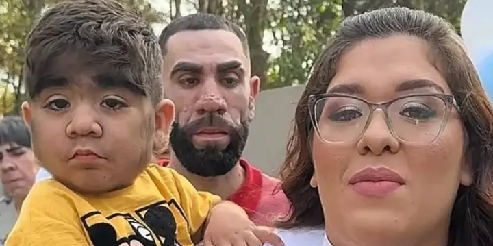 Dünyanın ən tüklü qızının QARDAŞI OLACAQ - FOTOLAR