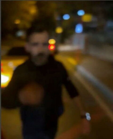 Azərbaycanlı müğənni İstanbulda taksi sürücüsü tərəfindən döyüldü - FOTO/VİDEO