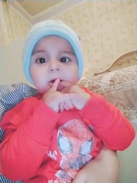 İki dəfə ürək əməliyyatı keçirən körpə Ümüdün atası: "Həkimə aparmağa imkanımız yoxdur" - FOTO